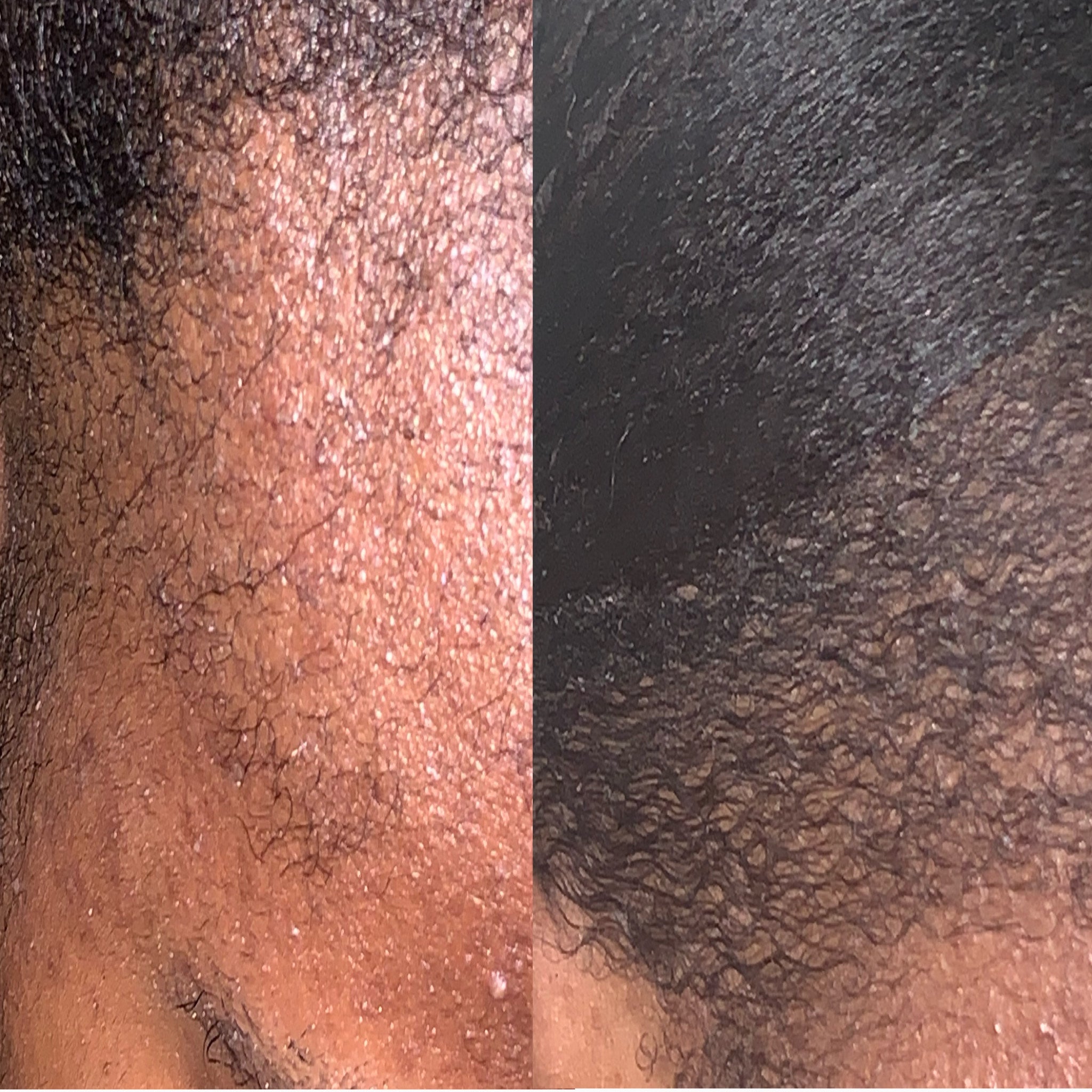 Anti breakage - hair growth oil
